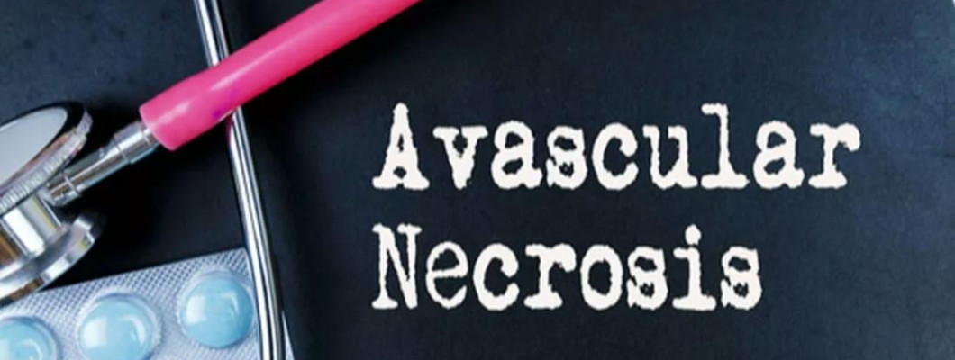 Avascular Necrosis Treatment Costs in India